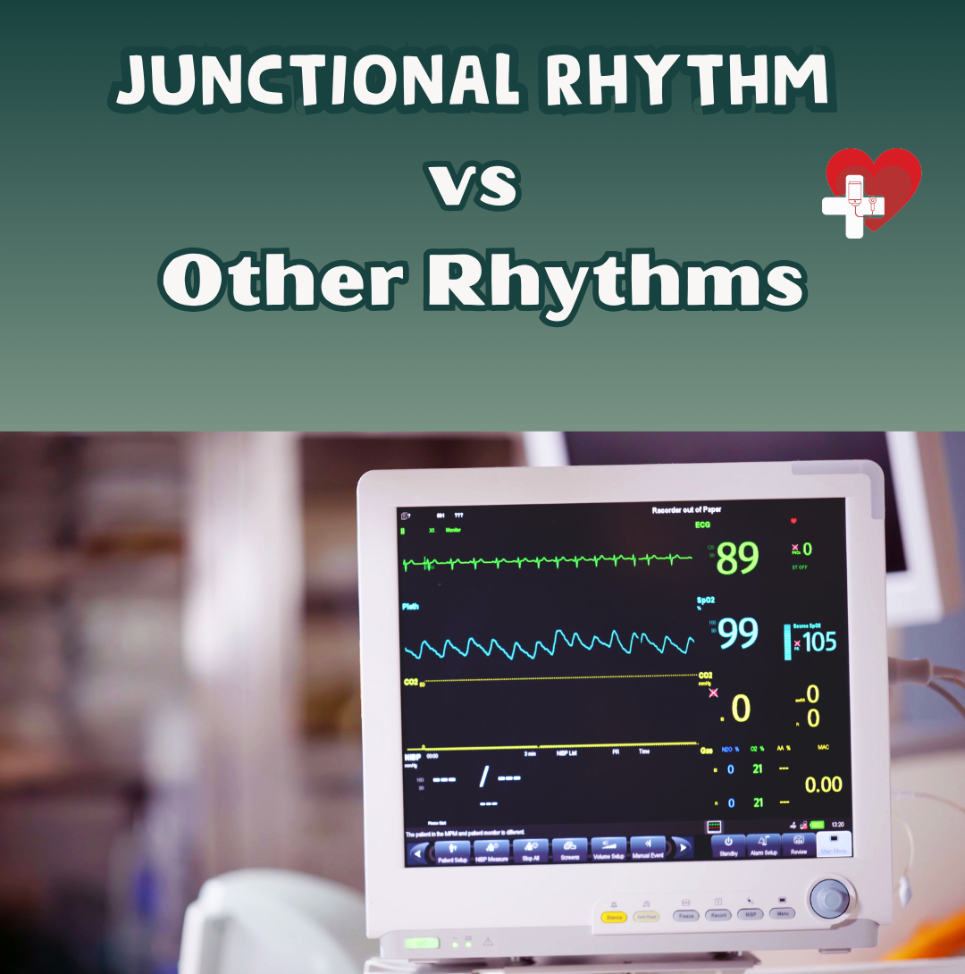 Juncitonal Rhytm Accelerated Junctional Rhythm vs Other Rhythms: What Nursing Students ...